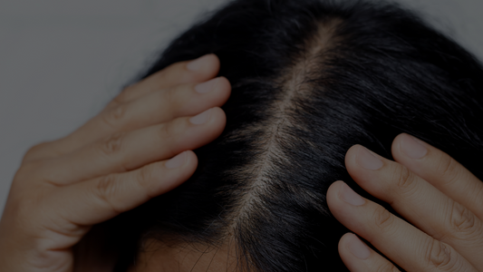 how to get rid of dandruff